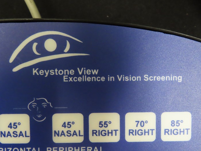 KEYSTONE VIEW VISION SCREENER MODEL 1155 for sale